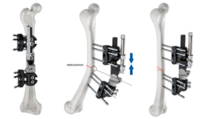 005_006_0008_transparent_max_250KB