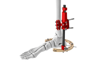 ankle_fixator_transparent_max200kb