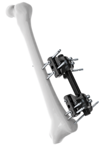 dist_fem_transparent_max_250KB